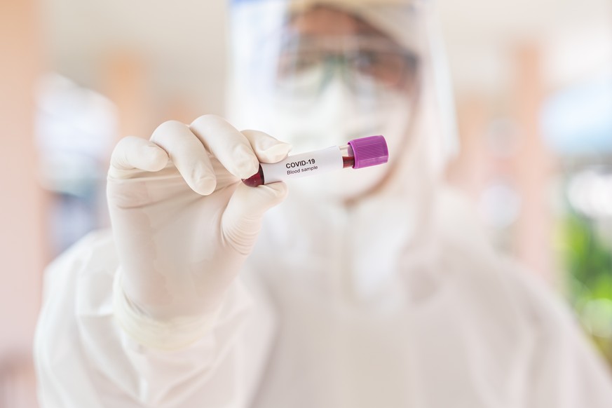 Asian male doctor holding Covid-19 Blood Sample on White Background