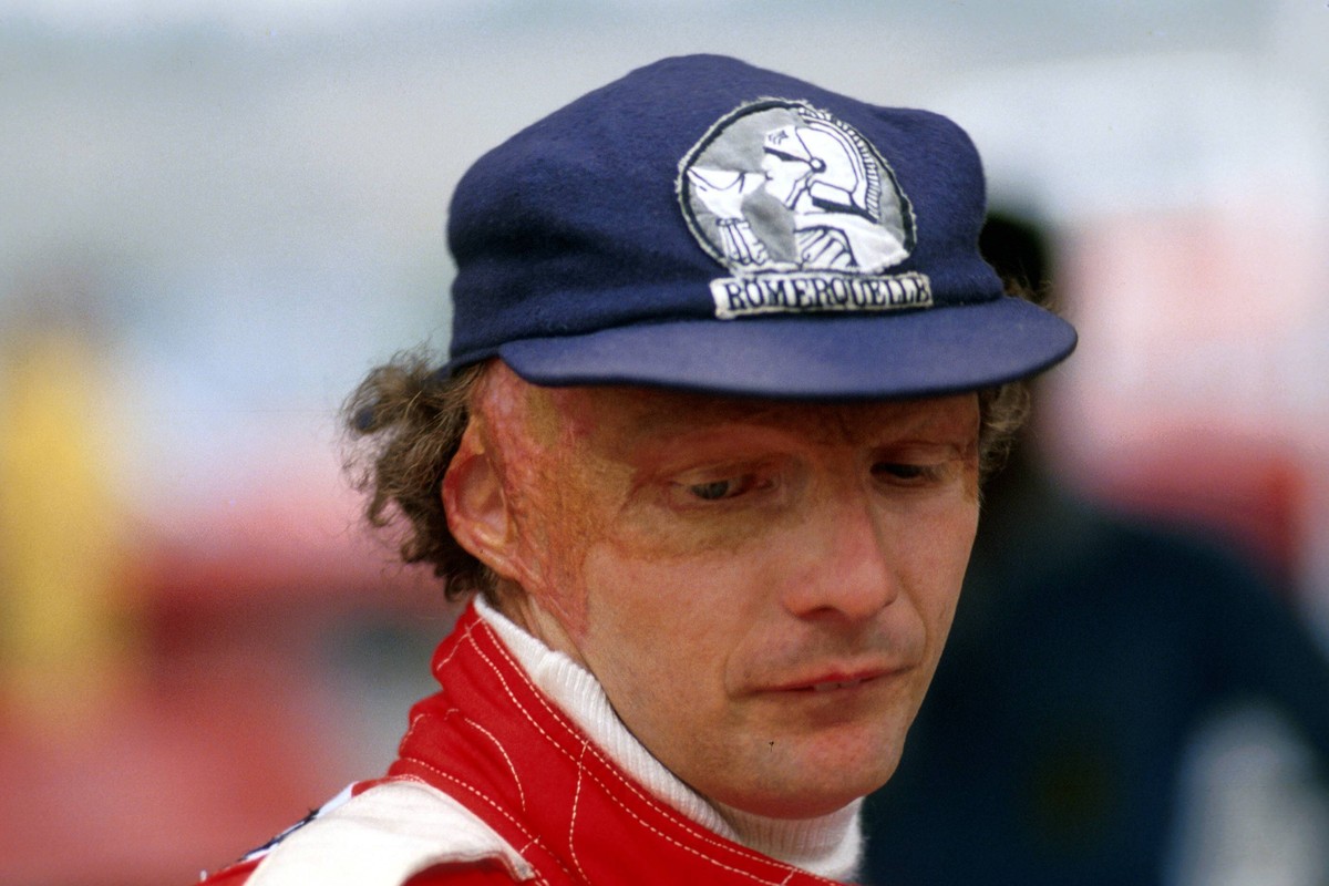 Lauda startet nur 42 Tage nach dem Horror-Crash zum GP von Italien in Monza.