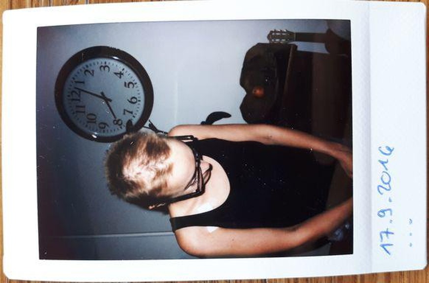 Mit Polaroid-Bildern dokumentierte Ronja ihren Krankheitsverlauf. Mitte September begannen ihr die Haare auszufallen.