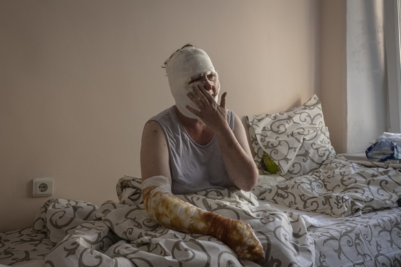 15.07.2022, Ukraine, Winnyzja: Ryna Wolkowa, 49, die durch einen Raketeneinschlag schwere Verbrennungen erlitten hat, weint nach der Behandlung in der Verbrennungsstation eines Krankenhauses in Vinnyt ...