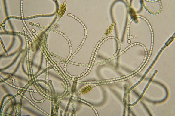Cyanobacteria or blue-green algae,