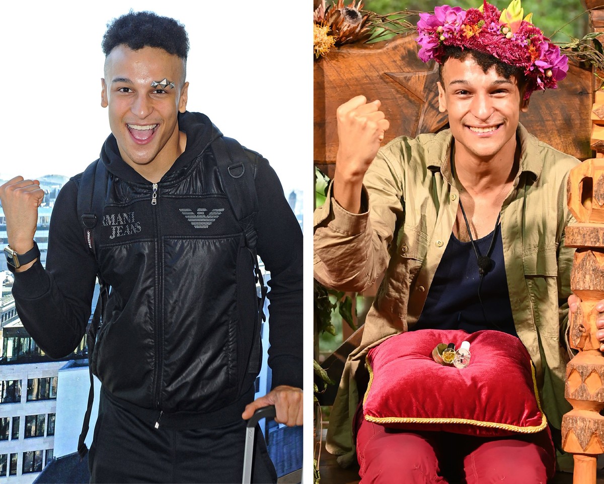 Dschungel-Stars vorher-nachher Prince Damien