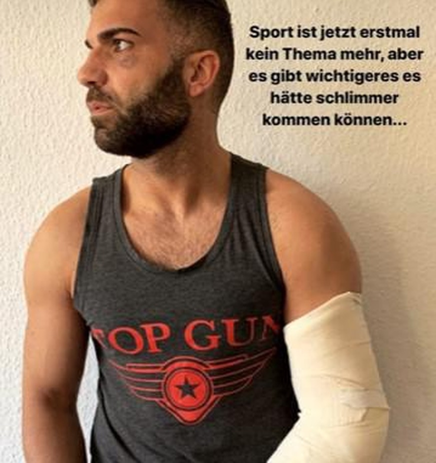 Rafi Rachek zeigte seine Verletzungen bei Instagram.