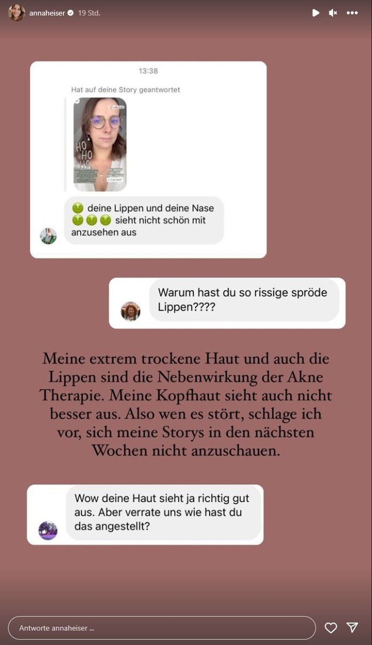 Anna Heiser geht auf Kommentare ein, die sich auf ihr Aussehen beziehen.