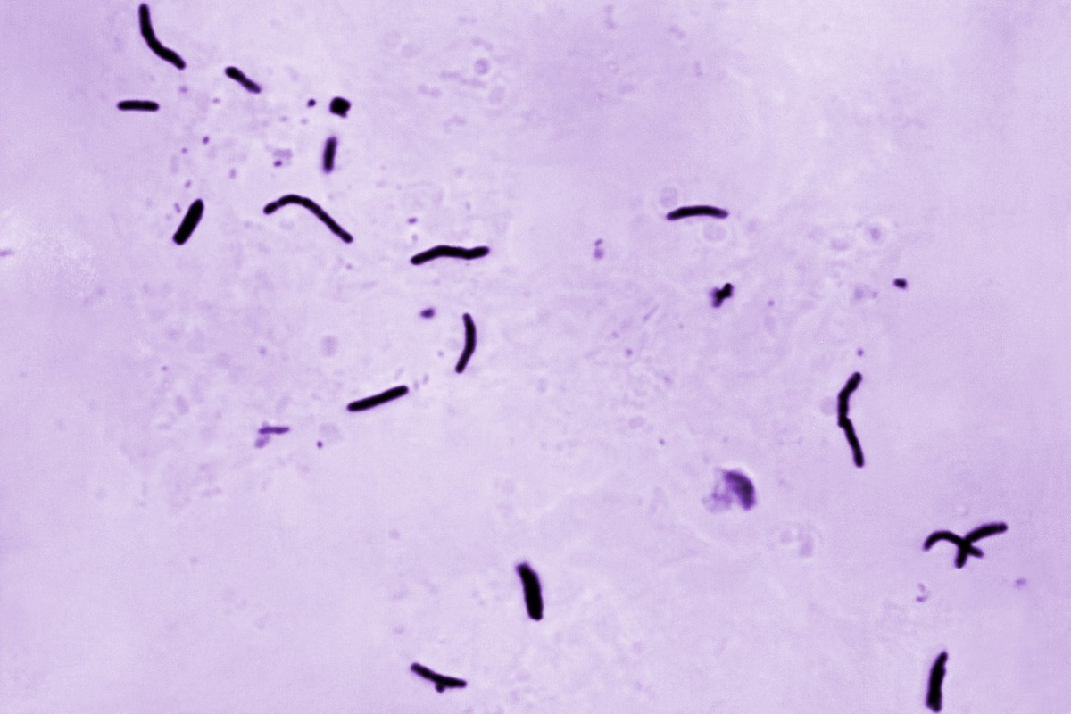 ARCHIV - 27.03.2024, USA, ---: HANDOUT - Dieses von den U.S. Centers for Disease Control and Prevention zur Verfügung gestellte Mikroskopfoto aus dem Jahr 1966 zeigt Mycobacterium tuberculosis Bazille ...
