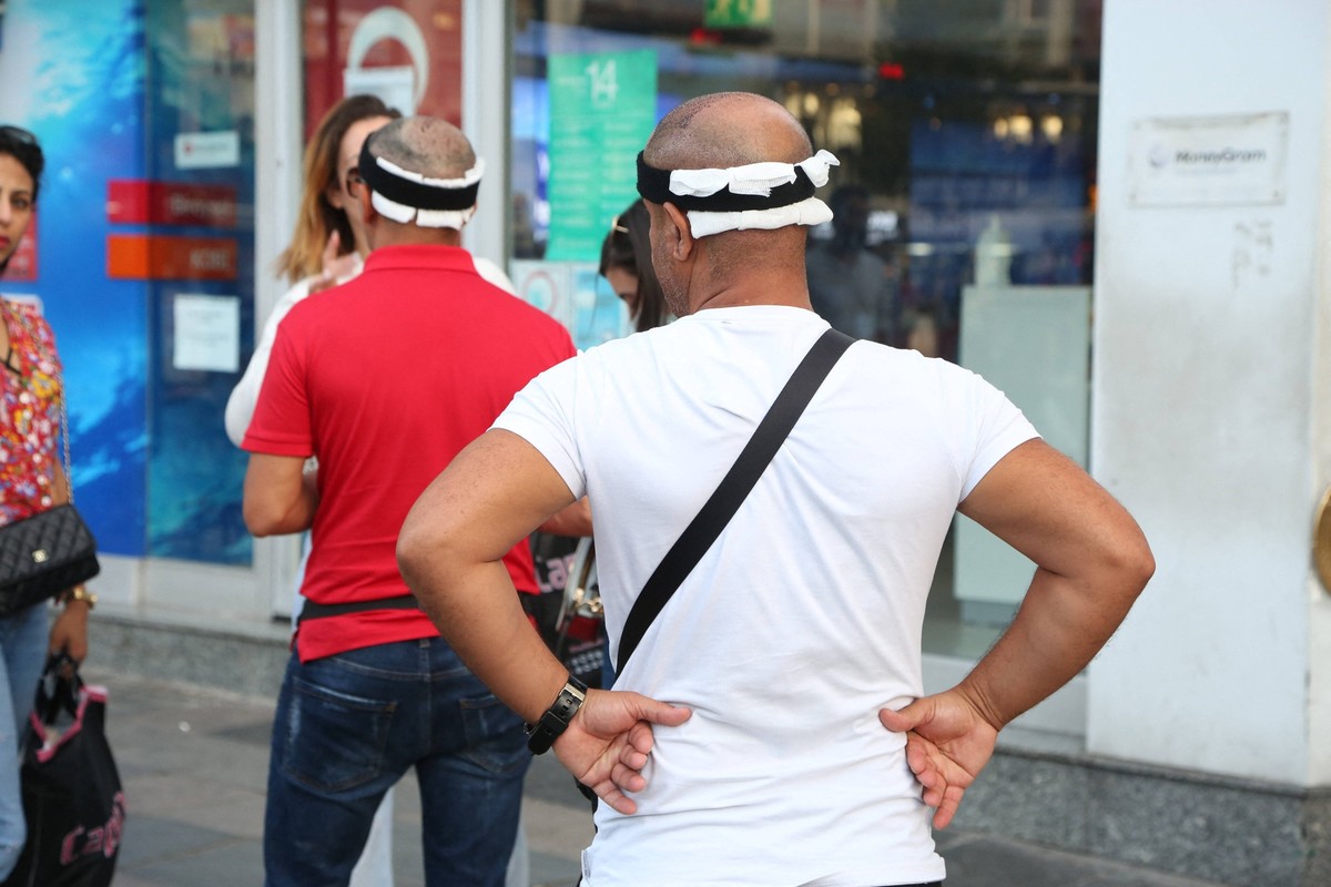 Hair Implants - Turkey Patients who have undergone hair transplant surgery at the BELLA HAIR clinic visit Istanbul. Cosmetic surgery is becoming more and more popular, and some countries, such as Turk ...