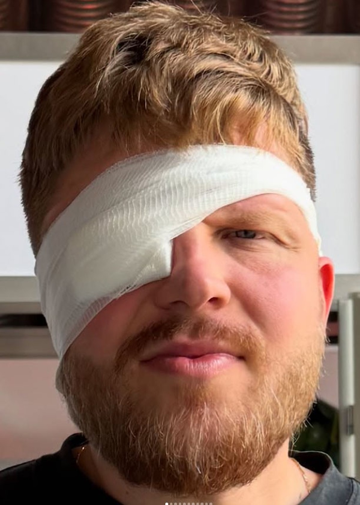 Finch muss einen Verband tragen.