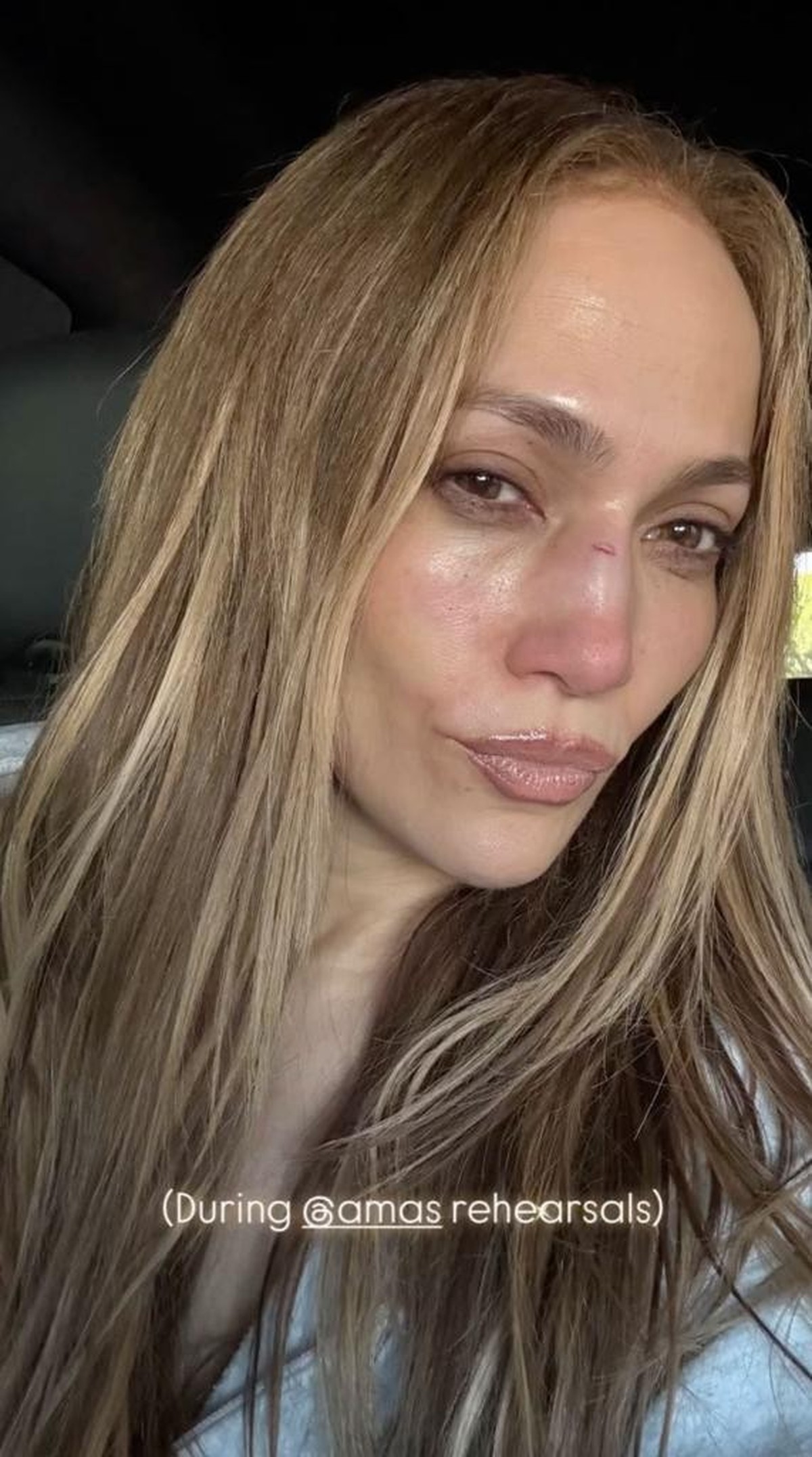 Jennifer Lopez und ihre Nasenwunde.