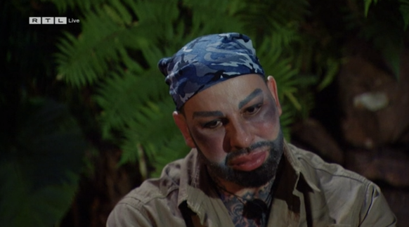 Am zweiten Tag im Dschungelcamp hatte Harald Glööckler plötzlich blaue Flecken im Gesicht. 