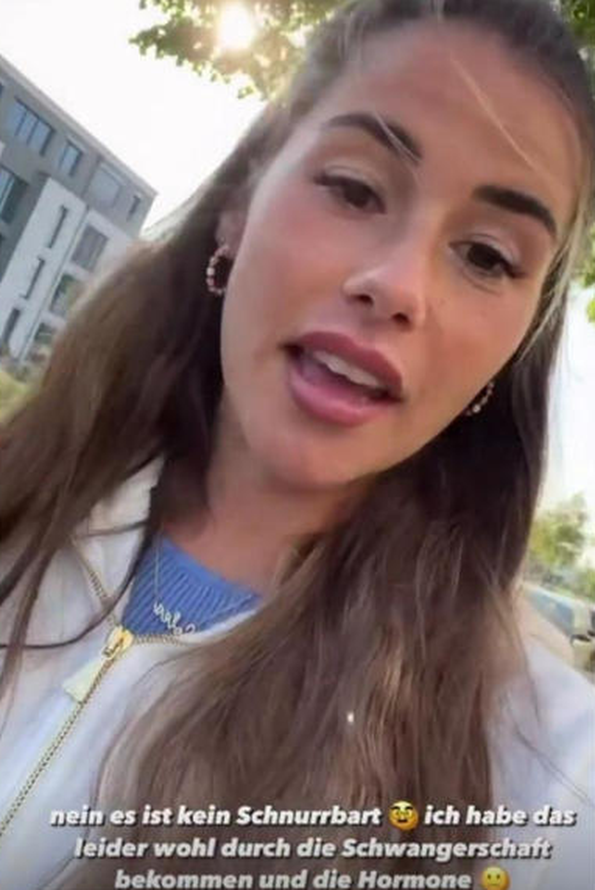 Sarah Engels spricht auf Instagram über ihre Melasmen.