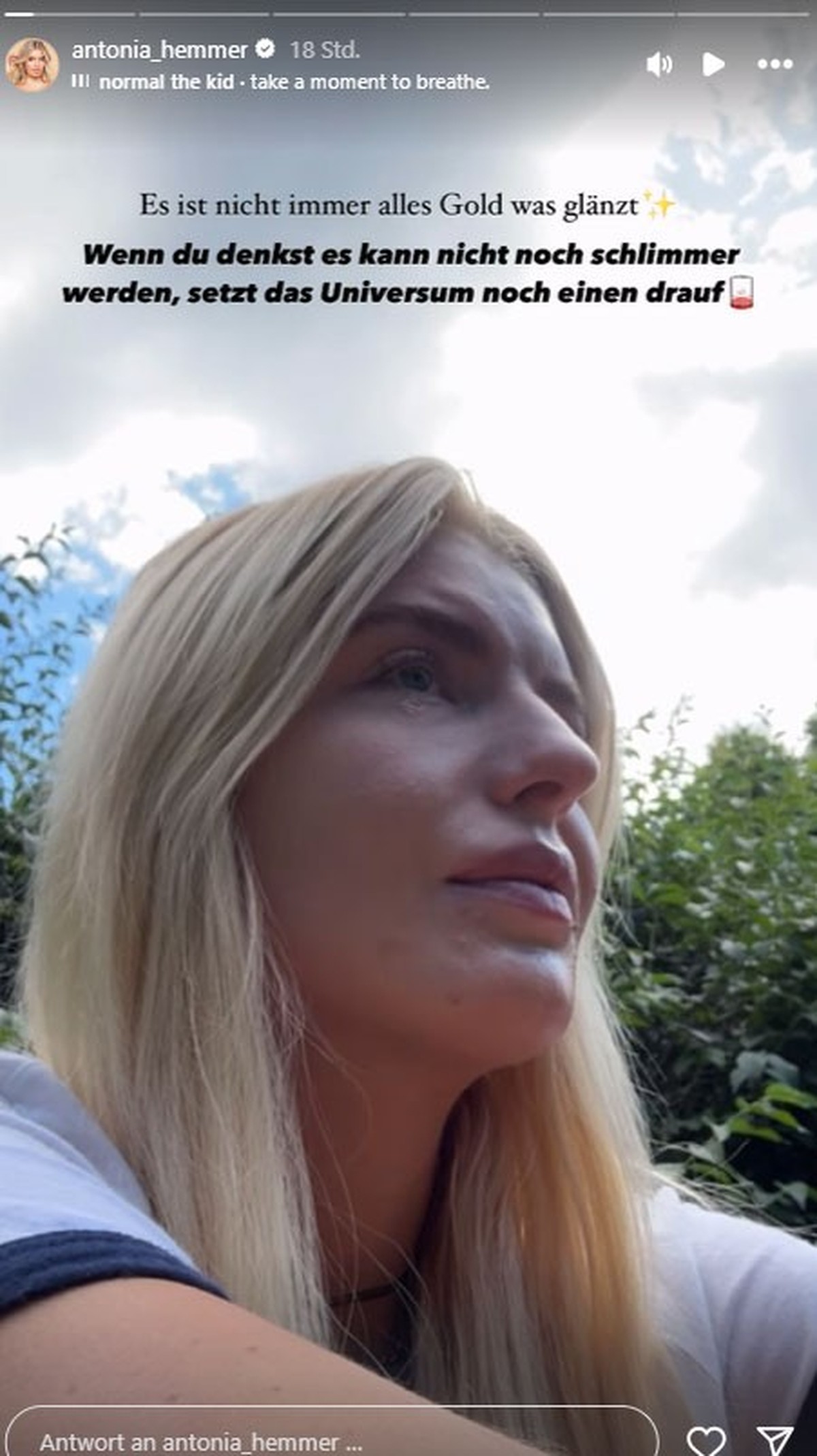 Antonia Hemmer zeigt sich angeschlagen in ihrer Instagram-Story.