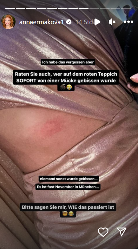 Anna Ermakova zeigt auf Instagram eine rote Stelle.