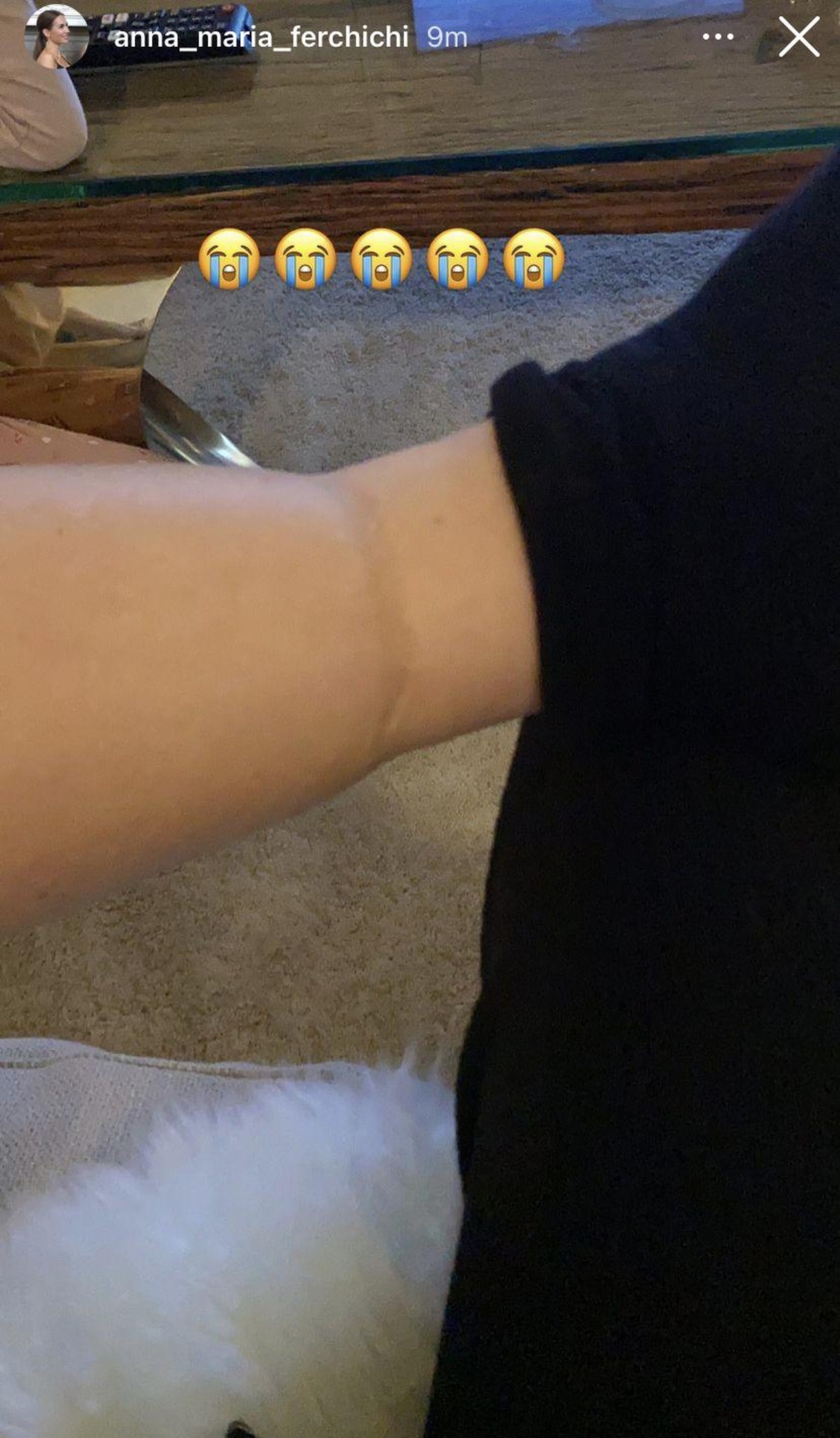So sieht derzeit der Arm von der 39-Jährigen aus.